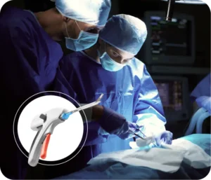 Repairable vs Unrepairable Tears: How Surgeons Decide – A Patient Checklist