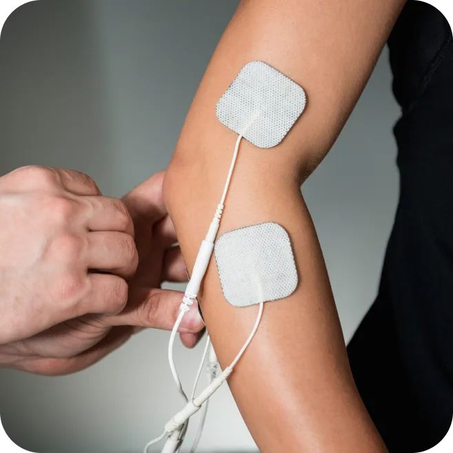 electrotherapy pads applied to elbow for nerve compression treatment and pain relief