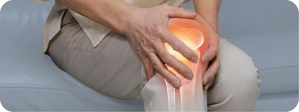 Older adult holding knee in pain with highlighted subchondral bone injury, illustrating symptoms of femoral and tibial subchondral fractures